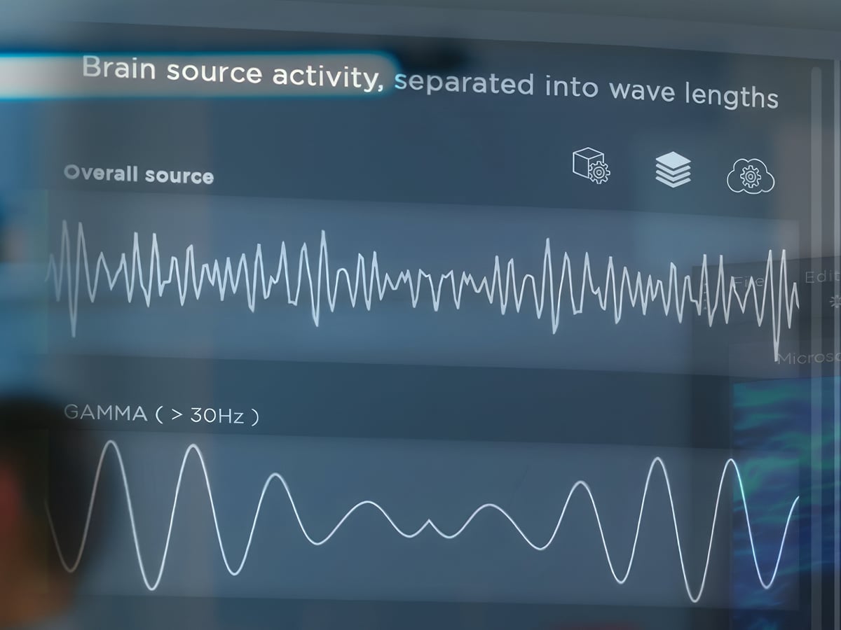Brainwave activity