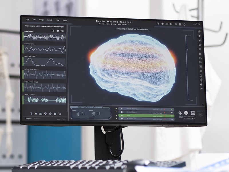 Brainwave monitor display